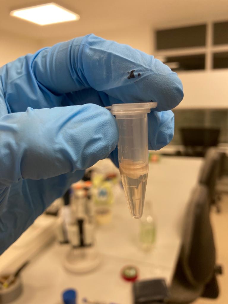 Fase acuosa tras extracción fenol-cloroformo